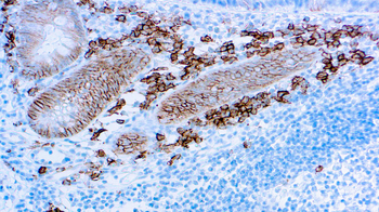 CD138 Antibody