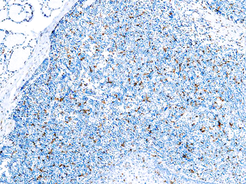 CD163 Antibody