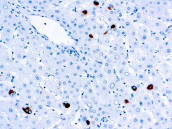 HEPATITIS B SURFACE ANTIGEN HBSAG Antibody