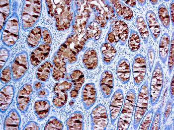 CA 19-9 Antibody