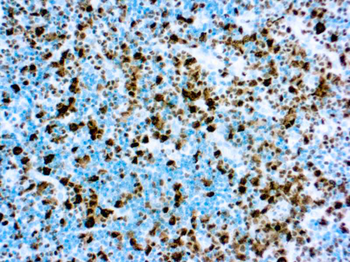 ALK/P80 Antibody