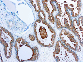 PSA Antibody