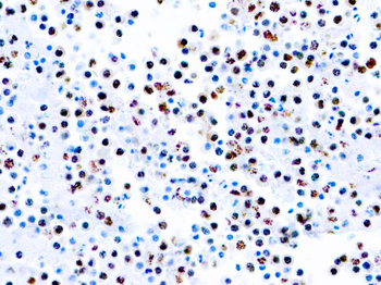 HHV8 Antibody