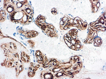 COLLAGEN IV