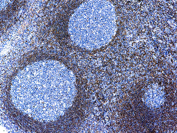 BCL-2 ONCOPROTEIN Antibody