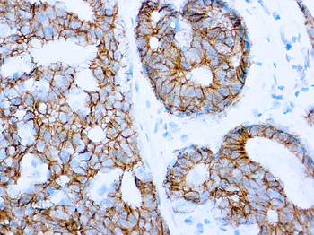 E-CADHERIN Antibody