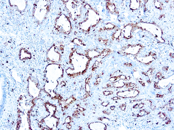 NAPSIN A Antibody