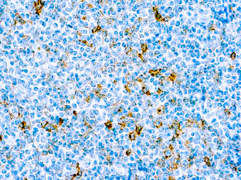 CD25 Antibody