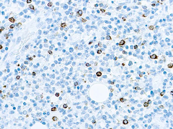 EBV COCKTAIL Antibody