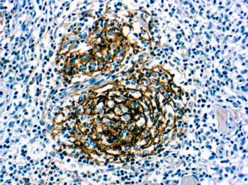 CD21 Antibody