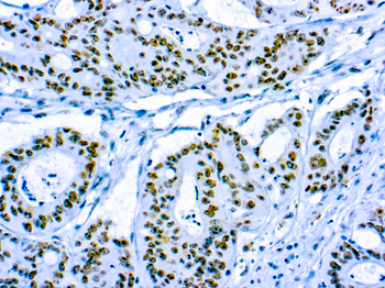 CD56 Antibody