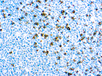 CD8 T-CELL Antibody