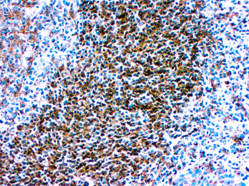 HLA-DR (Β CHAIN OF DP DQ AND DR) Antibody