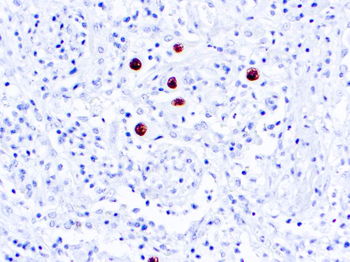 CMV COCKTAIL Antibody