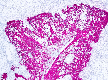 CYTOKERATIN HMW Antibody