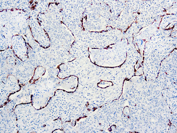 CYTOKERATIN AE1+AE3 Antibody
