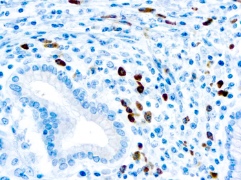 LAMBDA LIGHT CHAIN Antibody