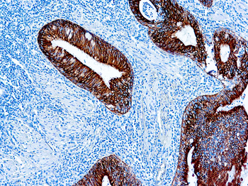 CYTOKERATIN AE1 ACIDIC Antibody
