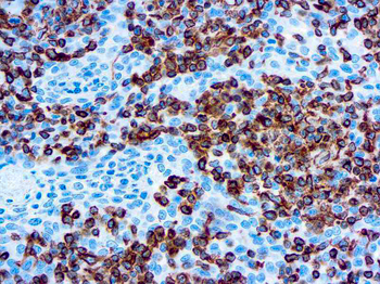 VIMENTIN Antibody