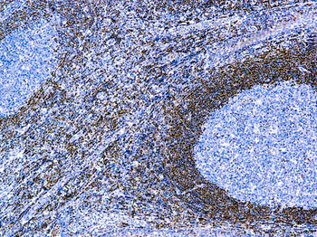 BCL-2 ONCOPROTEIN Antibody