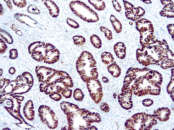 P53 Antibody
