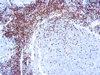 CD45 LCA Antibody