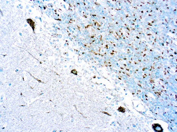 PAN-TRK Antibody