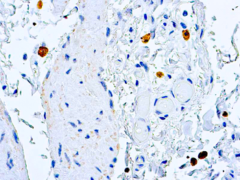 CASPASE 8 Antibody