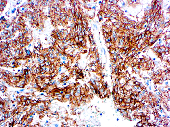 CD117/C-KIT