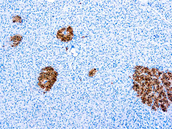 NEURON SPECIFIC ENOLASE Antibody