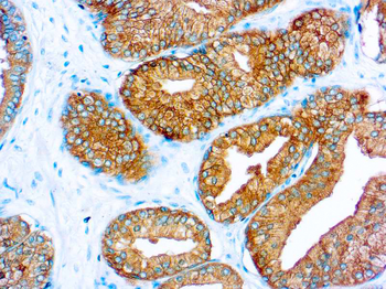 PSA Antibody