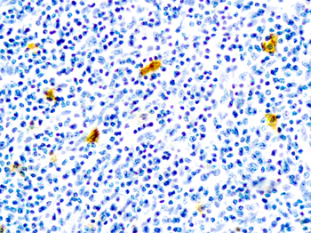 IGE Antibody