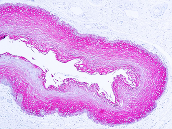 CYTOKERATIN WIDE SPECTRUM Antibody