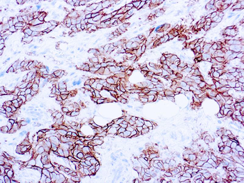 HER2/NEU (C-ERBB-2) Antibody