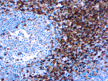 CD4 Antibody