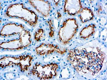 CD10 Antibody