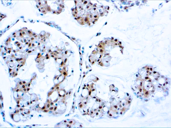 PTEN Antibody