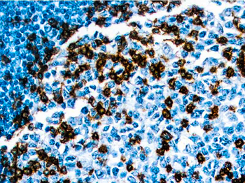 PD-1 Antibody