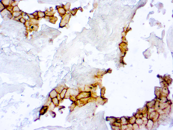 PD-L1 Antibody