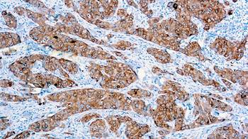 CA 15-3 Antibody