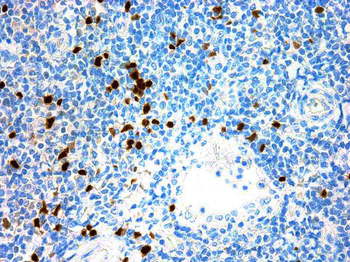 TDT Antibody