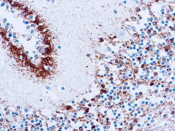 TAU (NEUROFIBRILLARY TANGLES MARKER) Antibody