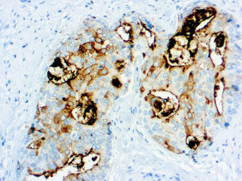 PSMA Antibody