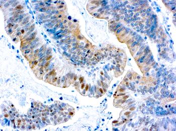 BRCA1 Antibody