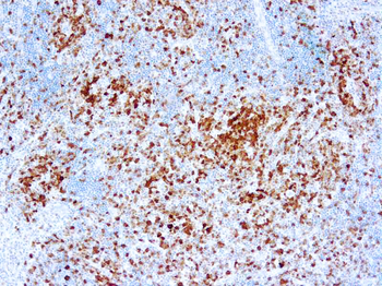 ALK P80 Antibody