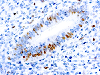 E2F-1 TRANSCRIPTION FACTOR Antibody