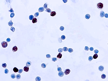 ADENOVIRUS Antibody