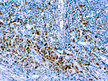 CASPASE 3 Antibody