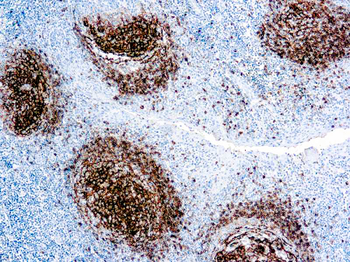 CD23 Antibody