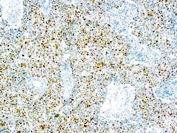 CYCLIN E PROTEIN Antibody